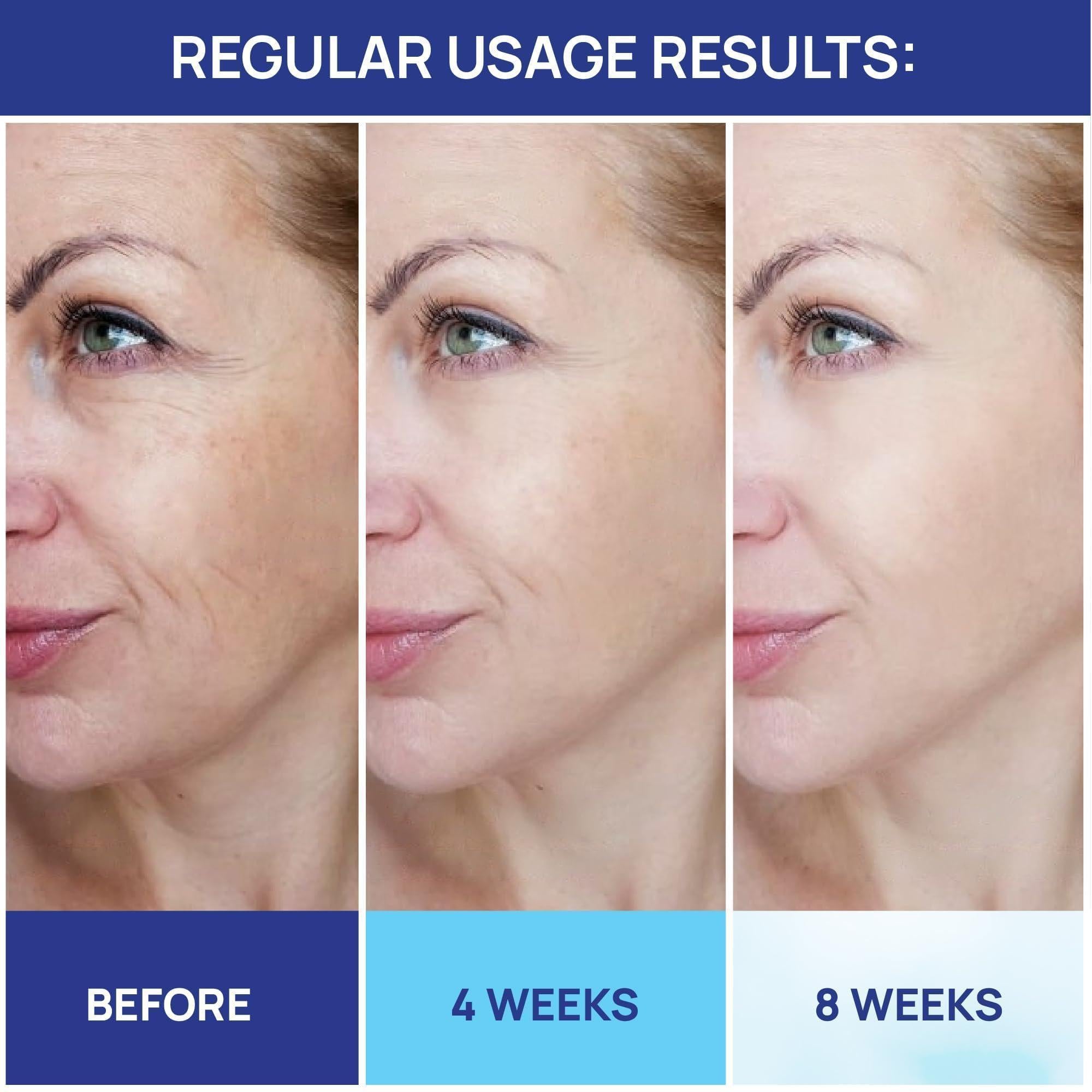 Crema de Retinol para la Cara, Humectante de Retinol con Colágeno y Ácido Hialurónico, 1.8 oz